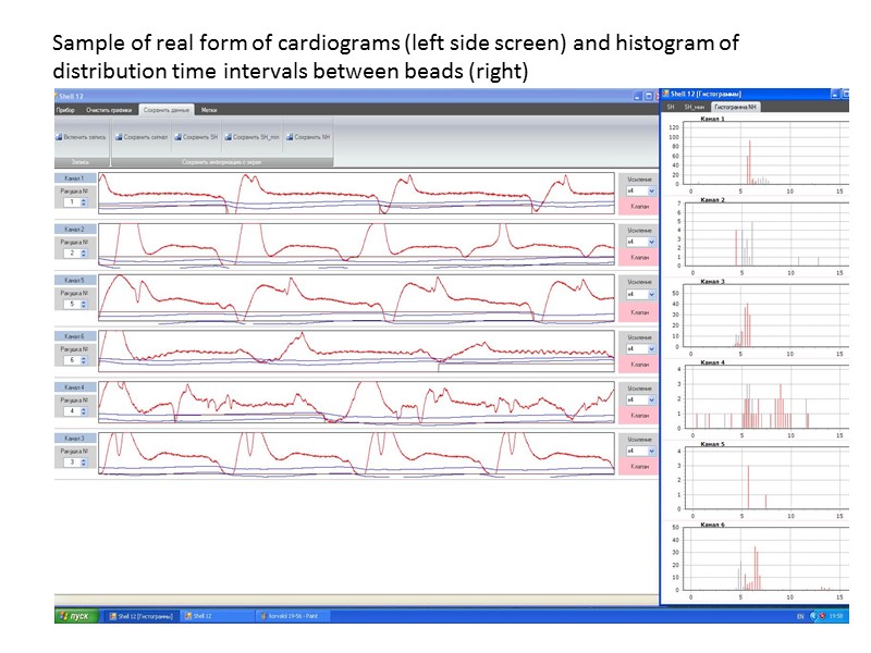 Sample of real form of cardiograms (left side screen) and histogram of distribution time